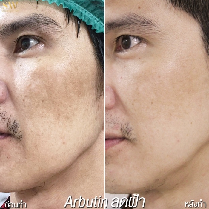 Kem dưỡng trắng da và giảm thâm nám 9IN1 dành cho nam giới