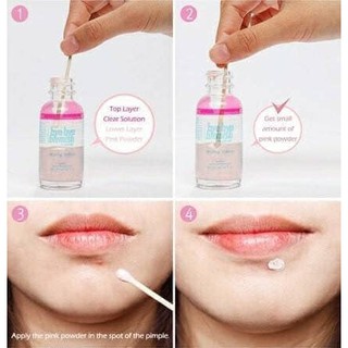 Kem Chấm Mụn Bye Bye Blemish Drying Lotion