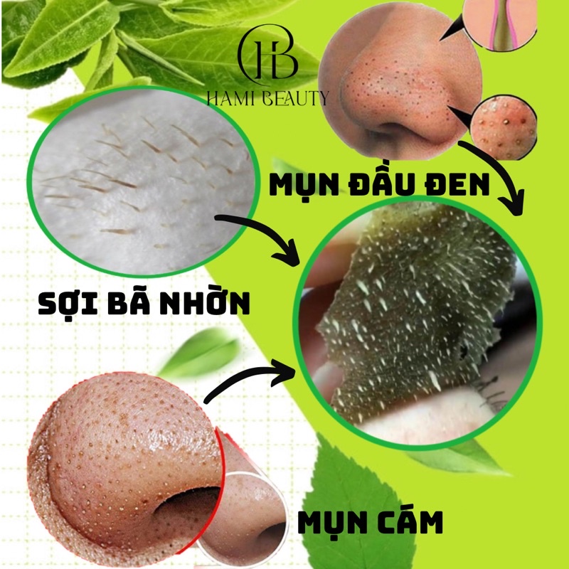 Lột mụn trà xanh từ lá trà xanh, sạch mụn, sạch bã nhờn, an toàn hiệu quả[ Thuỷ Mộc Beauty ]