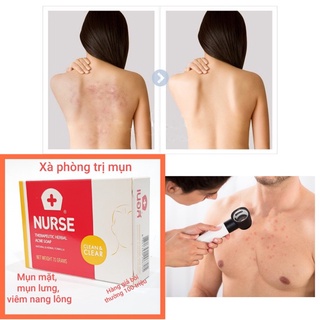 Xà Phòng (soap ) Loại Bỏ Mụn Lưng Thương Hiệu NURSE Thái Lan