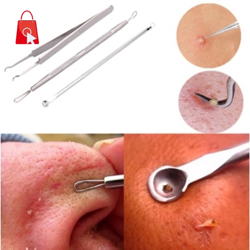 [Hàng mới về] 3 Dụng cụ nặn mụn đầu đen bằng thép không gỉ