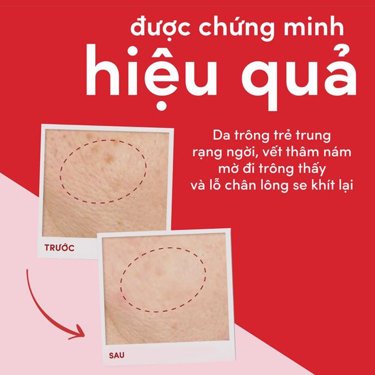 Kem  POND'S Chống Lão Hoá Ban Ngày Thái Lan Chính Hãng