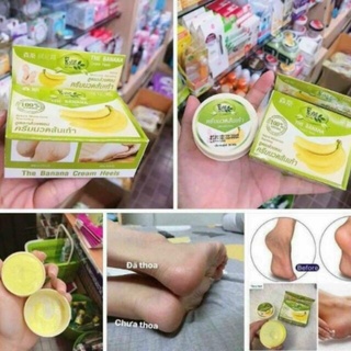 Kem bôi nứt gót chân Chuối Thái Lan