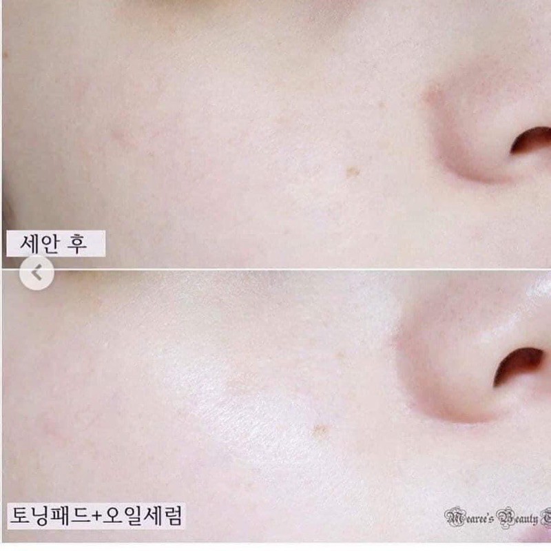 Serum skin booster milk oil