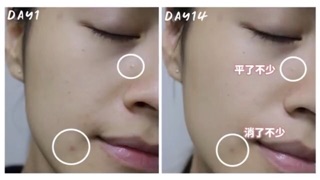 SẢN PHẨM DR WU MANDELIC ACID