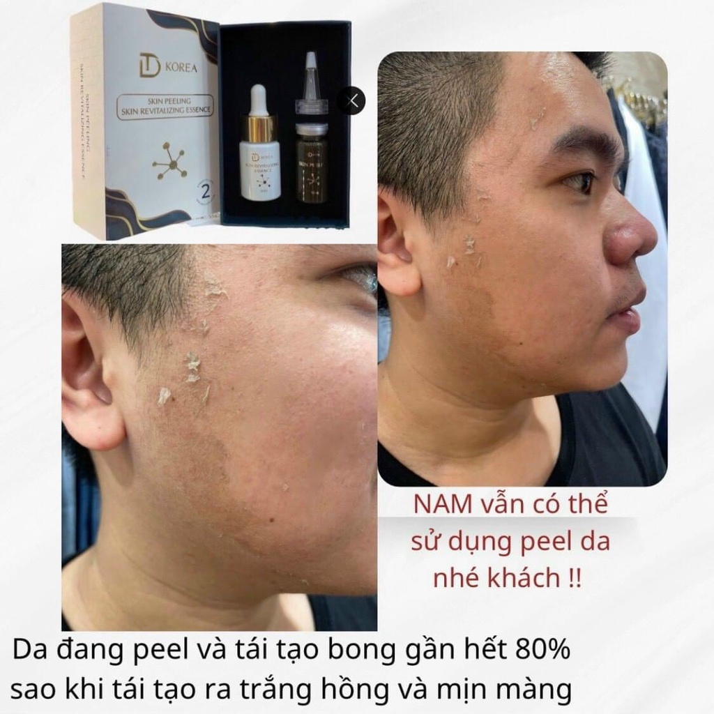 PEEL DA VI TẢO RETINOL TRANG NEMO - PEEL SỐ 1 VÀ PEEL SỐ 2 TÙY CHỌN