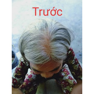 Dầu Gội Phủ Bạc Matrix Gội là Đen tóc 5 gói