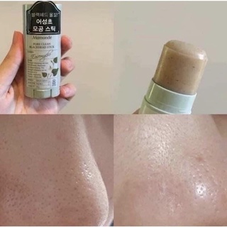 Thanh lăn mụn đầu đen mamo.de