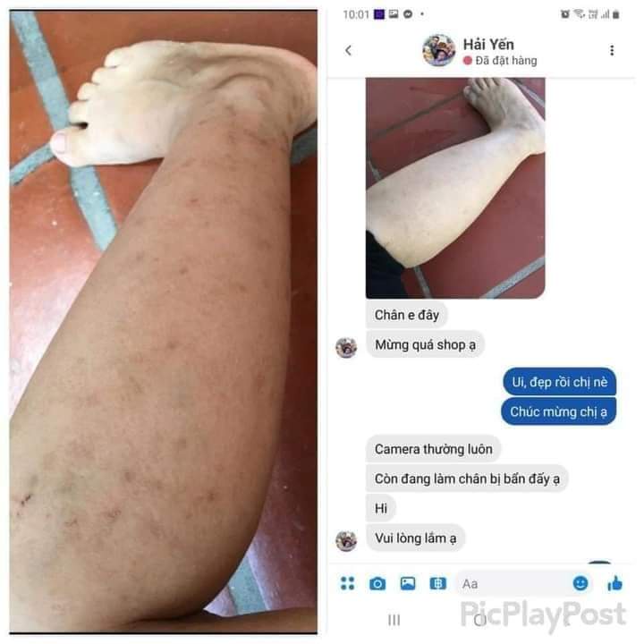 Serum giảm thâm Gia truyền, tinh chất giảm thâm mụn, thâm môi, mắt, nách, mông, vùng kín, đầu gối...