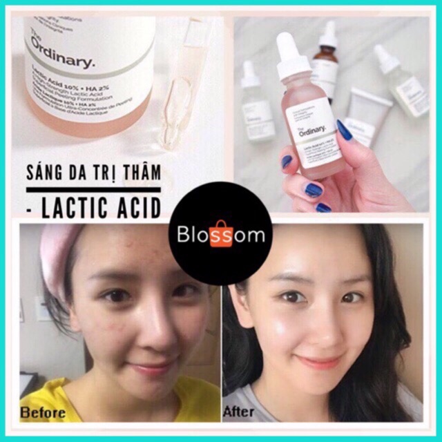 Sáng Da mờ Thâm Lactic Acid 10% + HA 2% - The Ordinary