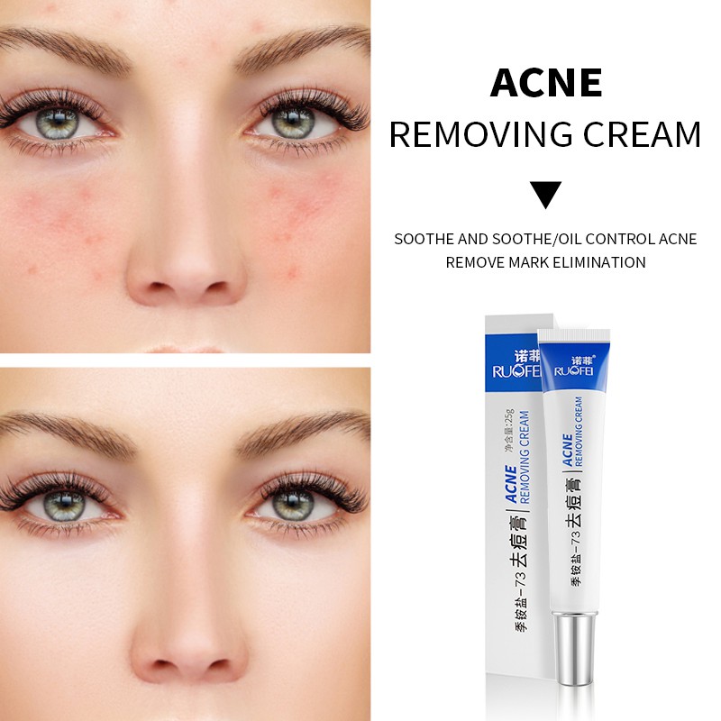 Combo RUOALL Pueraria lobata Kem nâng ngực 30ml + kem Roufei 25G | BigBuy360 - bigbuy360.vn