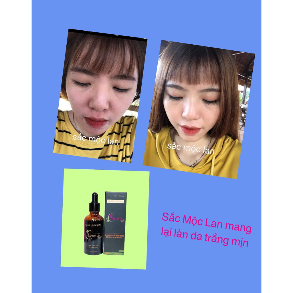 Sắc Mộc Lan - Tinh chất sạch mụn, mờ nám, tàn nhang, sẹo rỗ | BigBuy360 - bigbuy360.vn