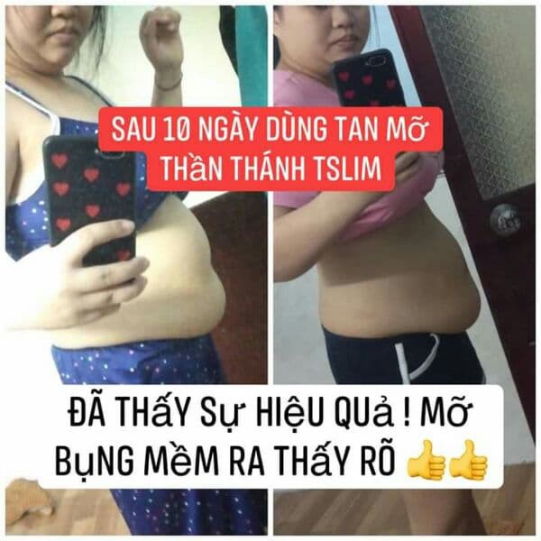 Tặng máy massage toàn thân Relax & tone khi mua 2 Kem tan mỡ Tslim body giảm ngay 5-10cm sau 1 tuyp sử dụng | BigBuy360 - bigbuy360.vn