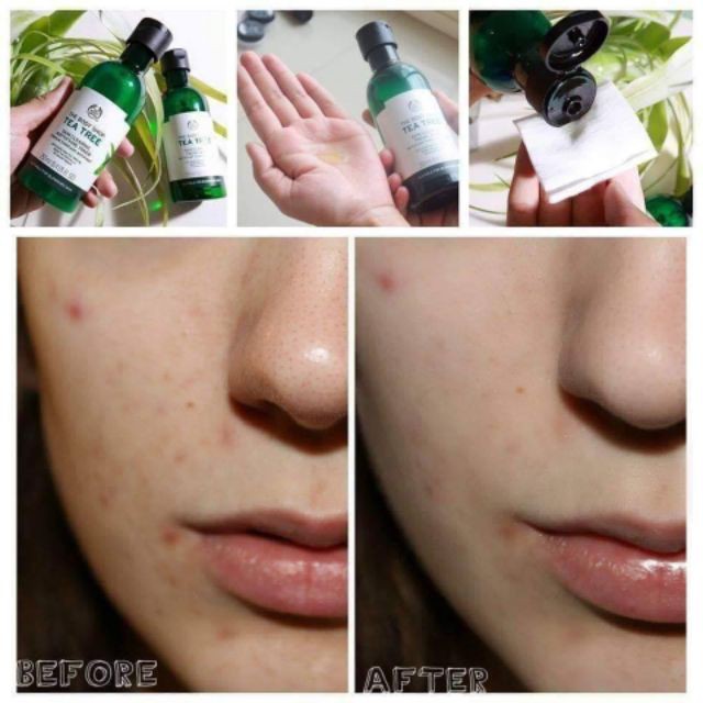 Toner Da Dầu Mụn The Body Shop Tea Tree Skin Clearing Mattifying Toner