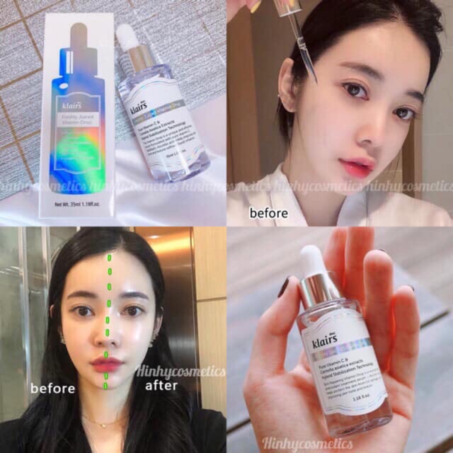 Serum tươi klairs