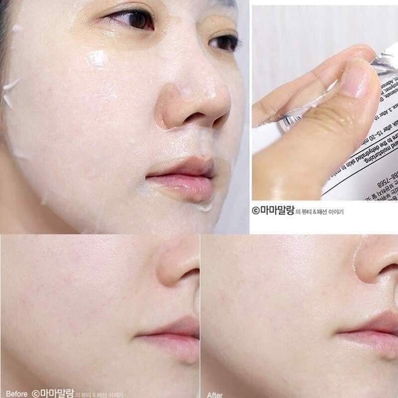 Mặt Nạ Dưỡng Da BNBG Vita Genic Jelly Mask 30ml Hàn Quốc Dạng Màu Đỏ Vitamin A (1 Miếng)
