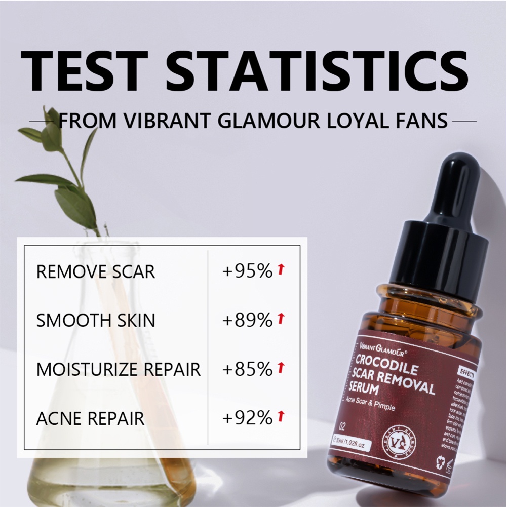 Vibrant Glamour Scar Repair Serum 30ml Điều trị mụn cá sấu thế hệ 2 Loại bỏ vết rạn da Loại bỏ sẹo mụn Dưỡng ẩm Chăm sóc da Beauty metro | BigBuy360 - bigbuy360.vn