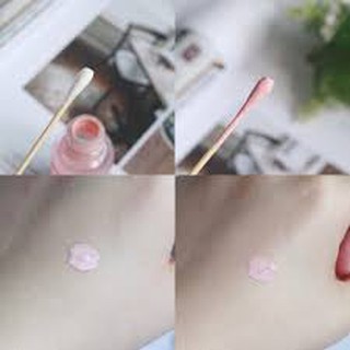 Kem Dành Cho mụn Bye Bye Blemish For Acne Drying Lotion