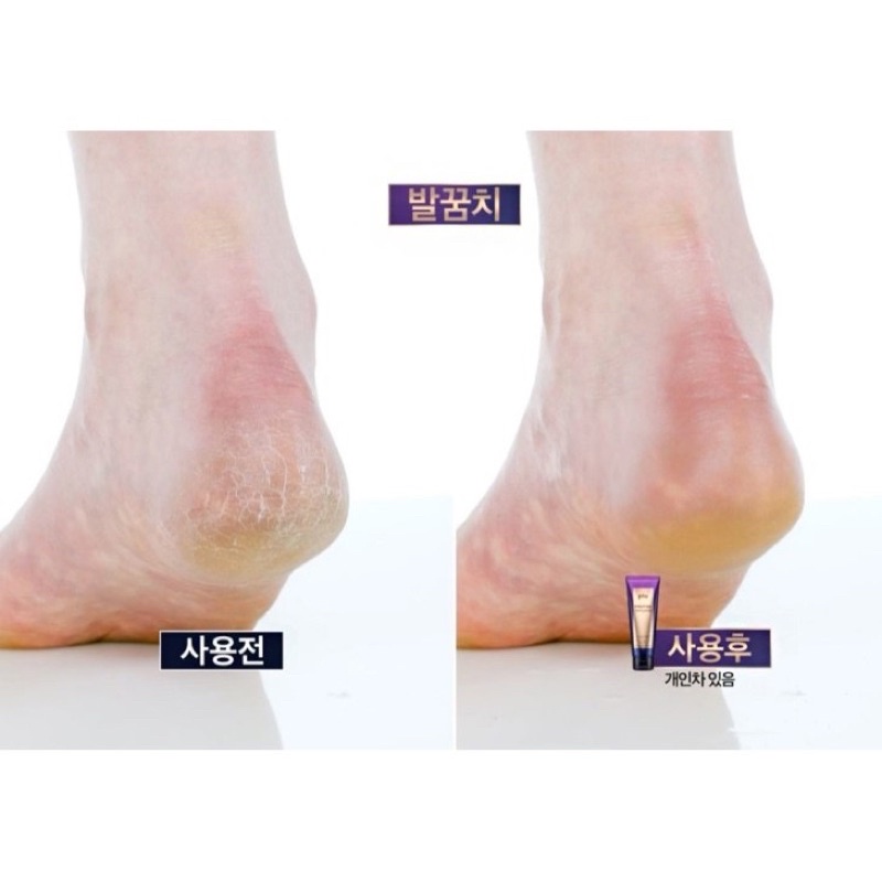 Tẩy tế bào chết trắng da Plu Body Scrub Therapy Edition | BigBuy360 - bigbuy360.vn