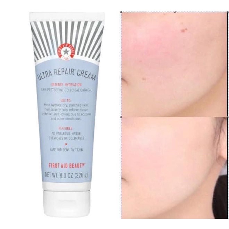 Kem dưỡng First Aid Beauty ULTRA REPAIR CREAM INTENSE HYDRATION 226gr