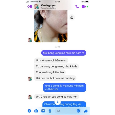 Kem Face nám tàn nhang da không đều màu