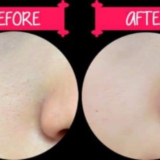 Serum melano CC nhật bản