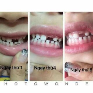 COMBO Kem Trắng Răng AP24 cùng sp Scion DDVS