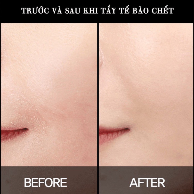 Tẩy tế bào chết hóa học Paula’s Choice Skin Perfecting 2% BHA Liquid, hàng công ty - có tem phụ