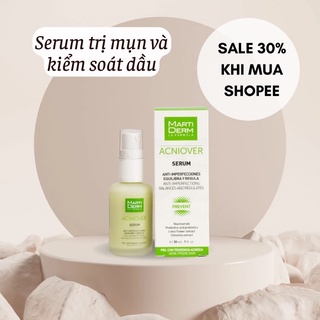 Serum dành cho da dầu mụn