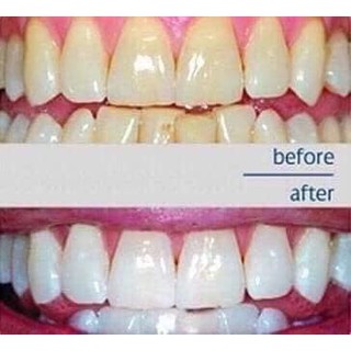 nước súc miệng