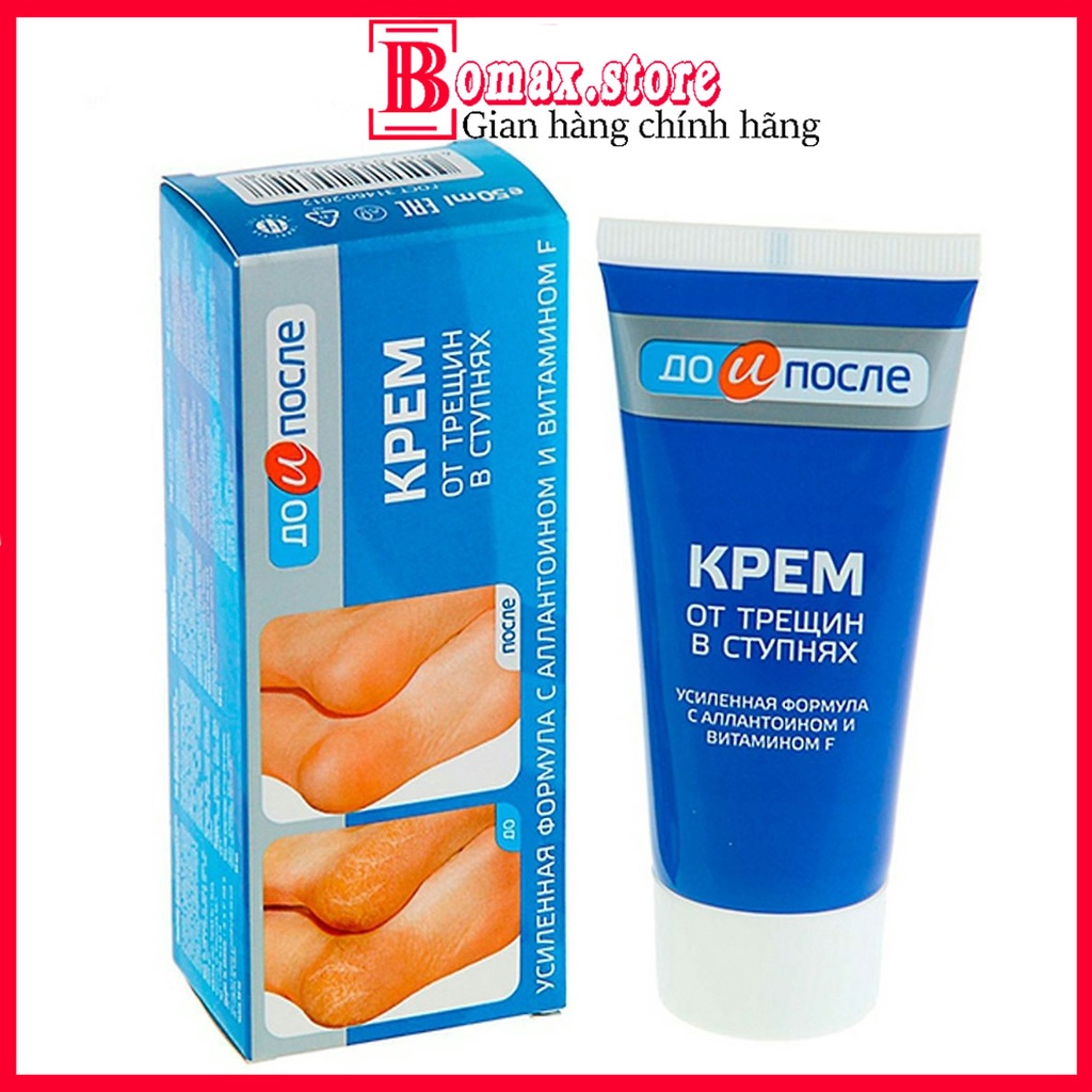 Kem Giảm nứt gót chân Kpem Apteka Nga 50ml Chính Hãng