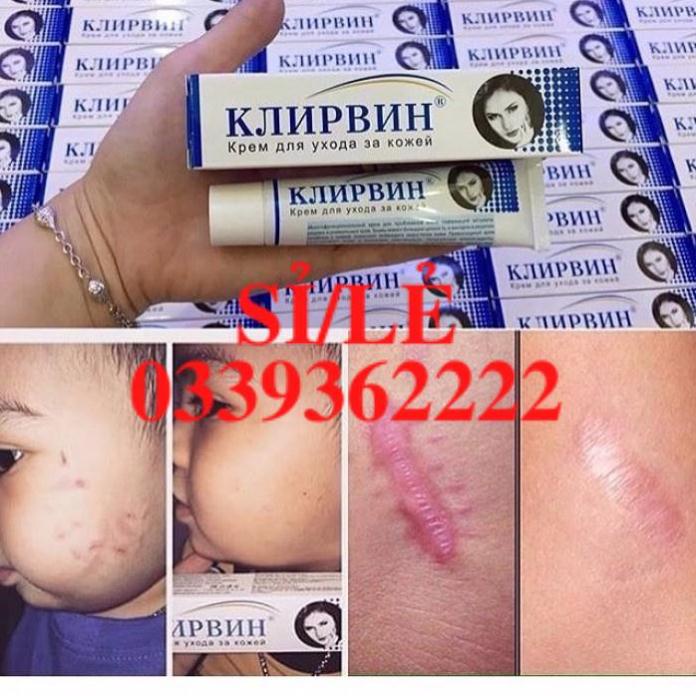 [ CHÍNH HÃNG ] Kem mờ sẹo Klirvin 25g của Nga Senabeauty