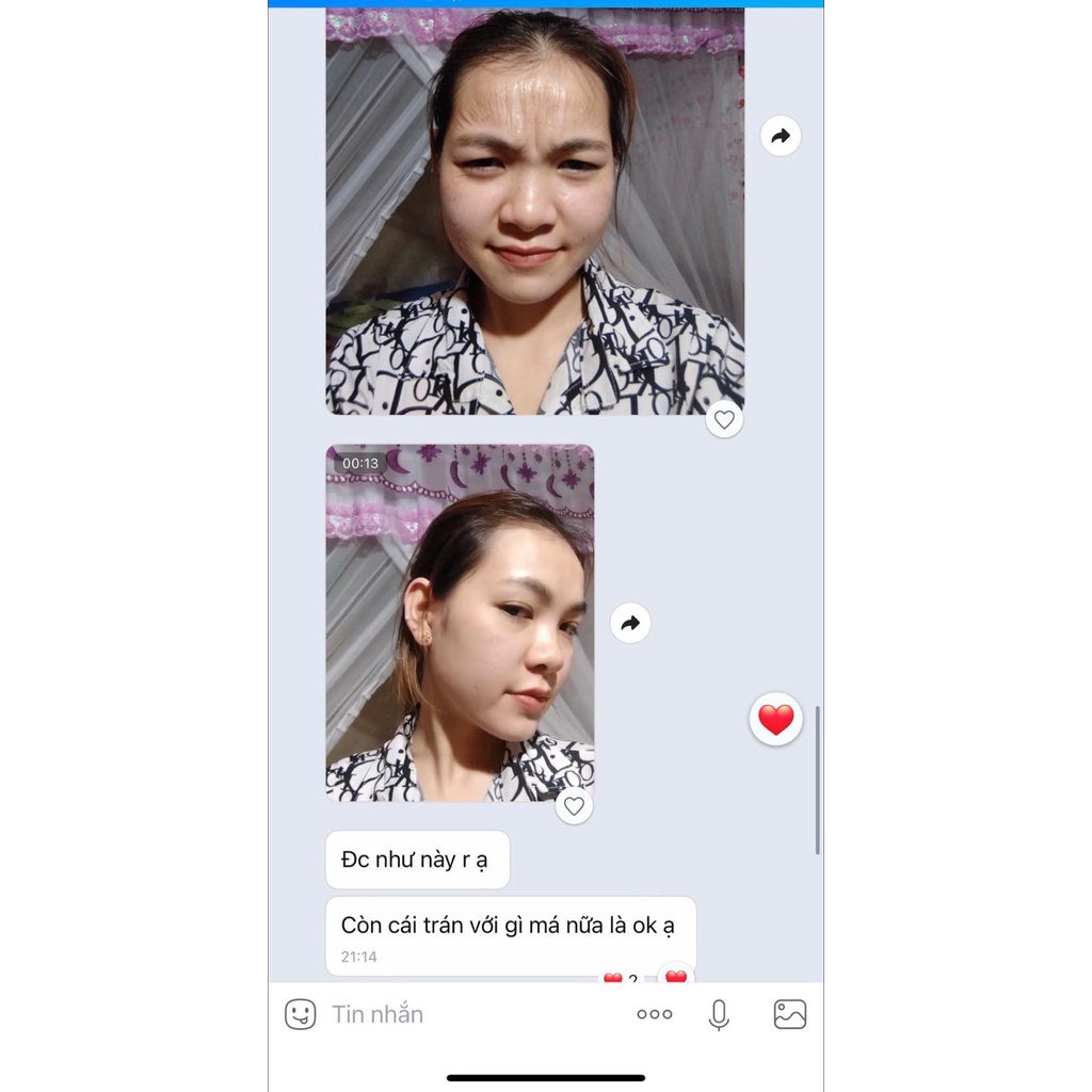 - Peel Da Vi Tảo Retinol Le'Peau Hoàng Thiên Sâm Tái Tạo Da 10ml 3-7 Ngày Xong Liệu Trình Bong da