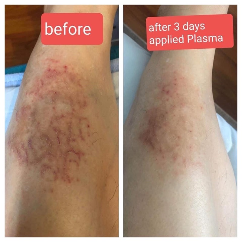 Huyết tương phục hồi làm dịu da Plasma Evenswiss 50ml