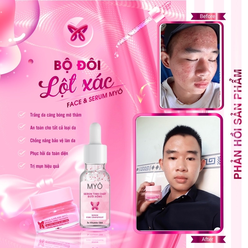 [CHÍNH HÃNG] COMBO SERUM + FACE 2TẦNG Dưỡng TrẮng Da Căng Bóng Mỗi Ngày