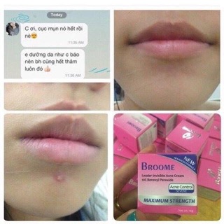 Kem Mụn Broome  ÚC