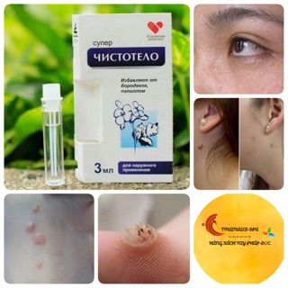 Gel Tẩy mụn thịt, mụn cóc , mục ruồi cynep của Nga