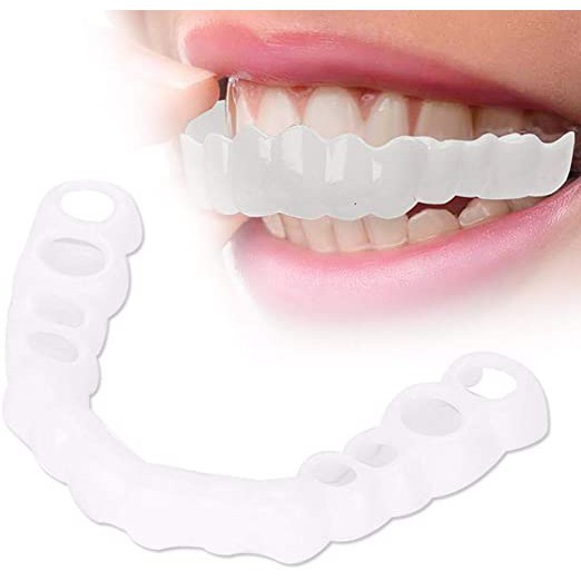 Dụng cụ niềng răng tại nhà snapon smile