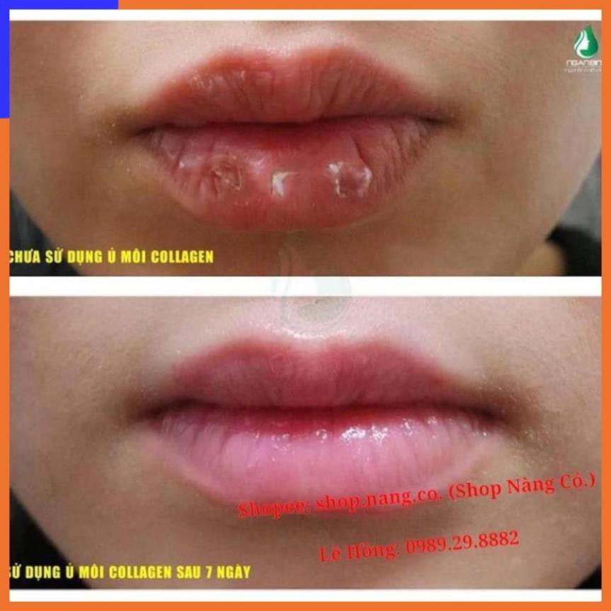 SON Ủ MÔI SHI - MỀN MÔI -DƯỠNG MÔI - HỒNG MÔI - TRỊ THÂM MÔI V V V | Thế Giới Skin Care