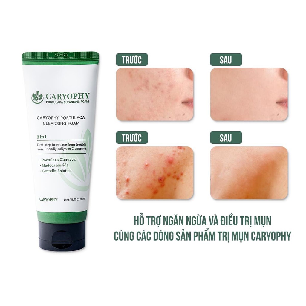 Sữa rửa mặt ngừa mụn Caryophy Portulaca 150ml | BigBuy360 - bigbuy360.vn