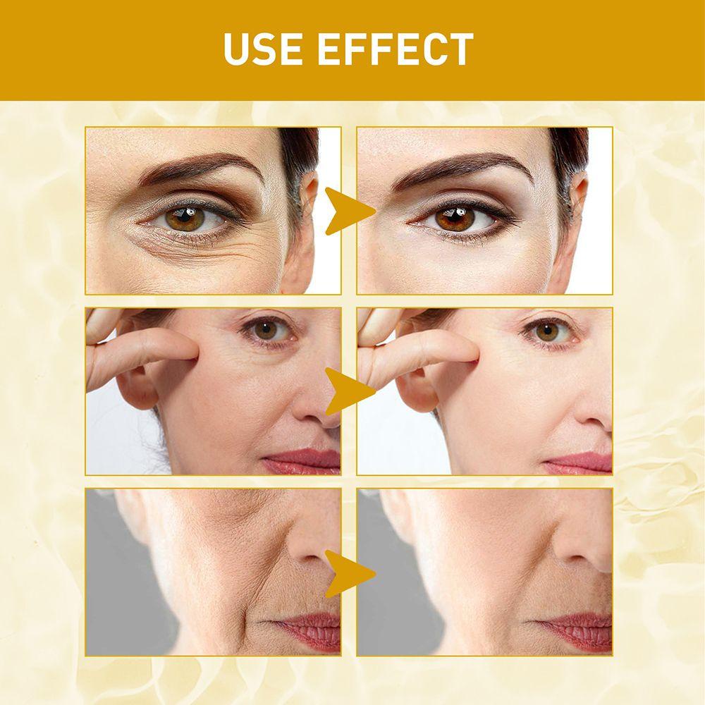 Set 2 Serum Xóa Nếp Nhăn Tức Thì Giúp Làm Trắng Và Săn Chắc Da ESPO