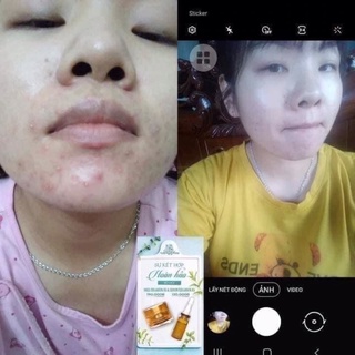 kem face collagen X3