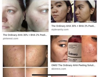 [BILL SEPHORA]THE ORDINARY PEELING SOLUTION AHA BHA TẨY DA CHẾT TẾ BÀO