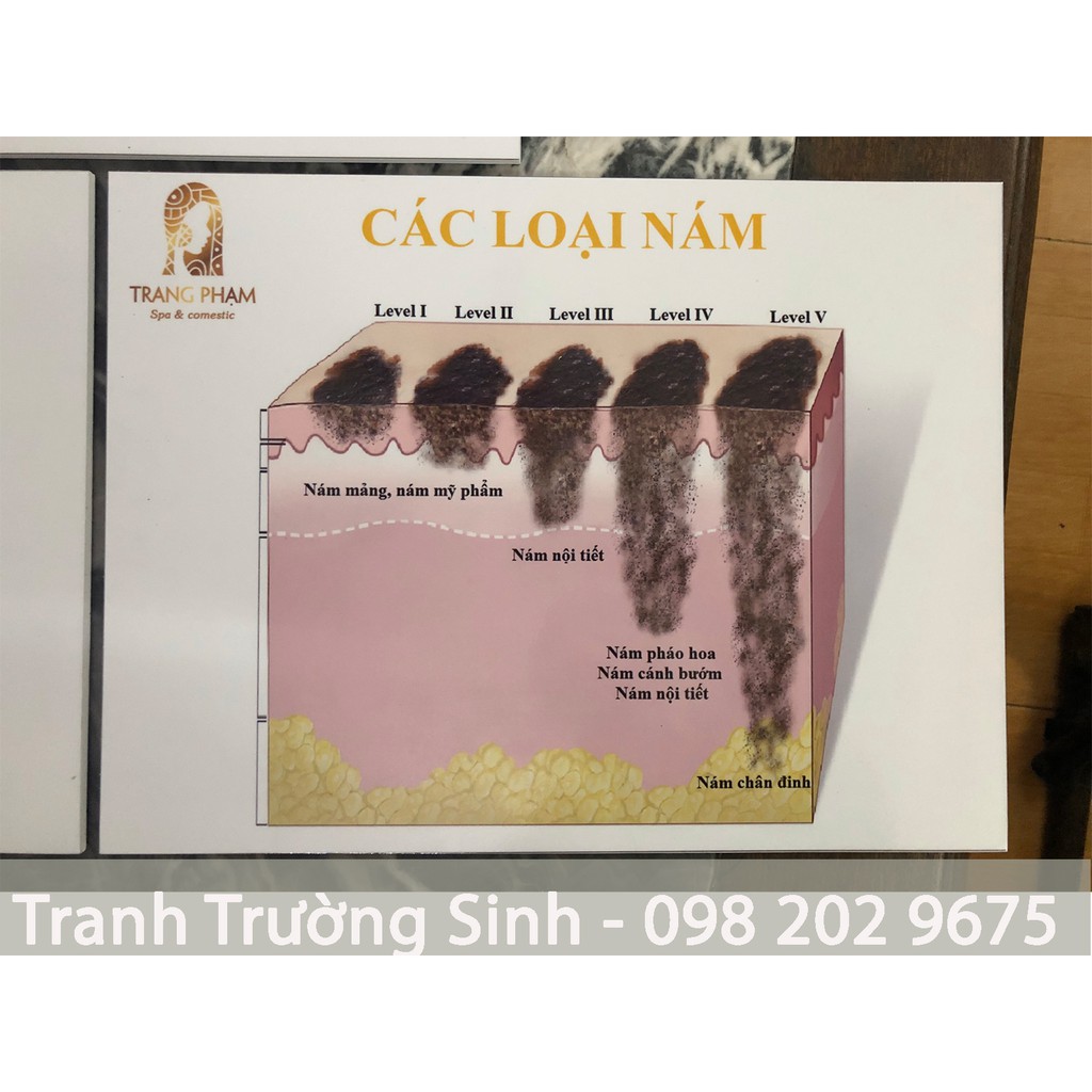 BỘ 3 TRANH CẤU TRÚC DA