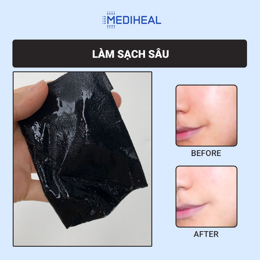 Mặt Nạ Than Hoạt Tính Loại Bỏ Bã Nhờn, Giảm Mụn Đầu Đen, Mụn Cám Mediheal Aqua Black Solution Mask 23ml [K113]