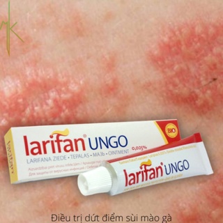 Kem bôi Larifan Ungo Sùi mào gà, gai mụn cóc, mụn rộp