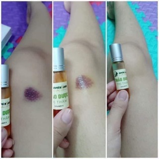 Combo 5 sản phẩm dưỡng da