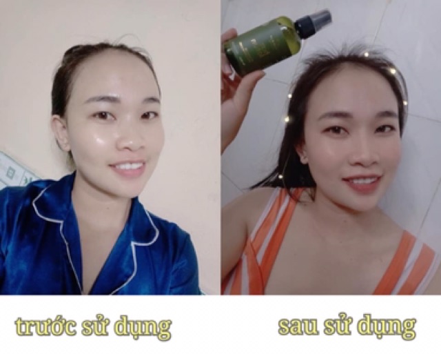 TINH DẦU BƯỞI KÍCH MỌC TÓC , TRỊ RỤNG , TRỊ HÓI MUA 3 CHAI ĐƯỢC GIÁ SỈ