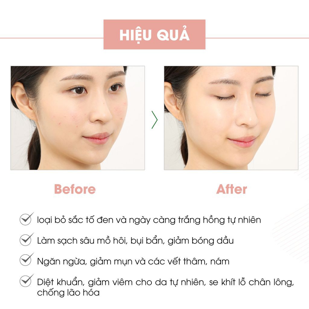 Sữa rửa mặt giảm mụn than hoạt tính Acne Cleanser, nhiều bọt giúp sạch da, đẹp da, trắng da. Tuýp 60ml | BigBuy360 - bigbuy360.vn