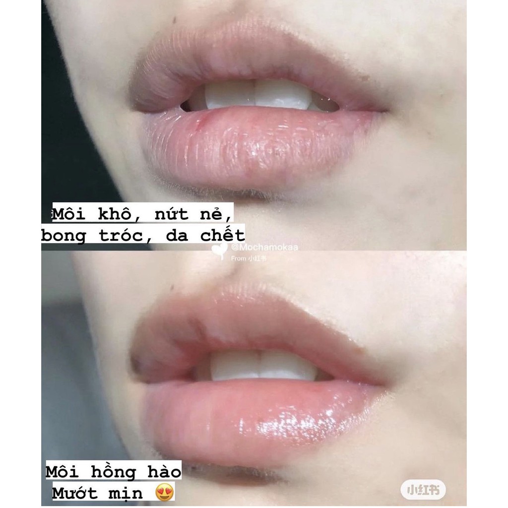 Son dưỡng Bio.der.ma